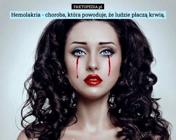 
    Hemolakria - choroba, która powoduje, że ludzie płaczą krwią.