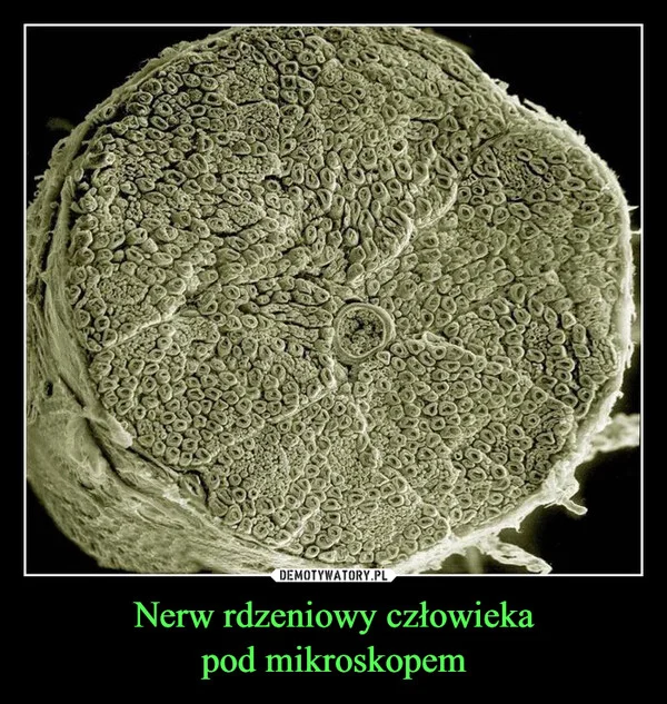 Nerw rdzeniowy człowieka pod mikroskopem