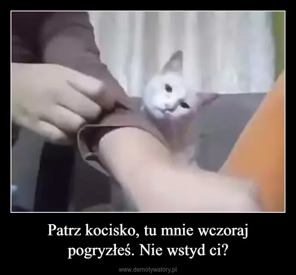 
    Patrz kocisko, tu mnie wczoraj pogryzłeś. Nie wstyd ci?