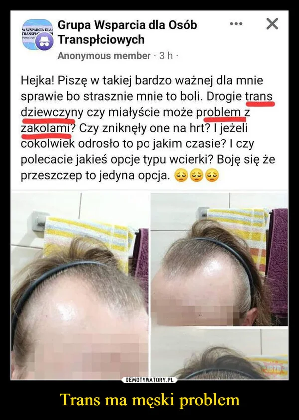 
    Trans ma męski problem