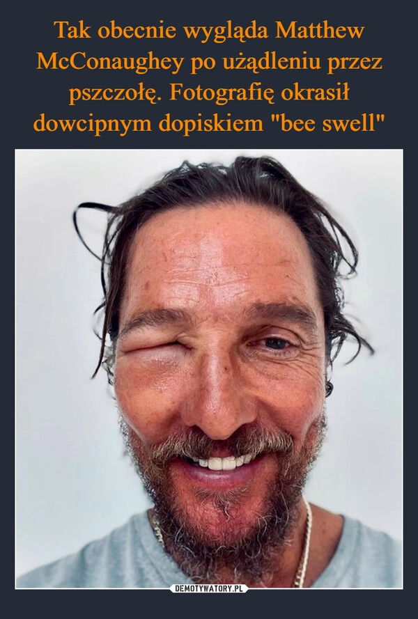 
    Tak obecnie wygląda Matthew McConaughey po użądleniu przez pszczołę. Fotografię okrasił dowcipnym dopiskiem "bee swell"