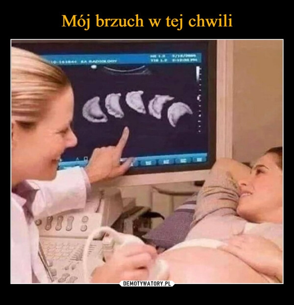 
    Mój brzuch w tej chwili