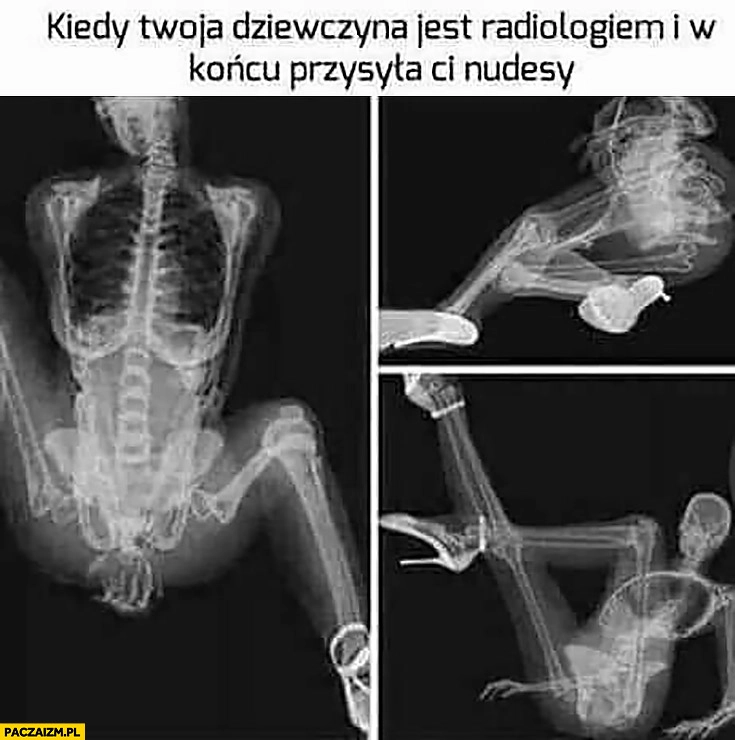 
    Kiedy Twoja dziewczyna jest radiologiem i w końcu przysyła Ci nudesy