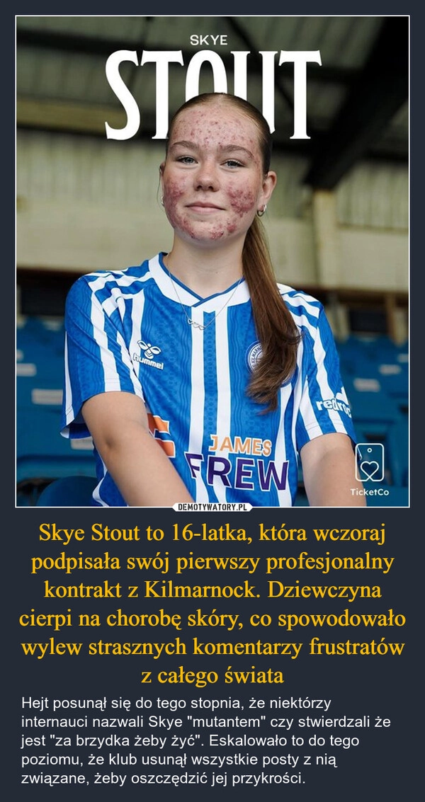 
    Skye Stout to 16-latka, która wczoraj podpisała swój pierwszy profesjonalny kontrakt z Kilmarnock. Dziewczyna cierpi na chorobę skóry, co spowodowało wylew strasznych komentarzy frustratów z całego świata