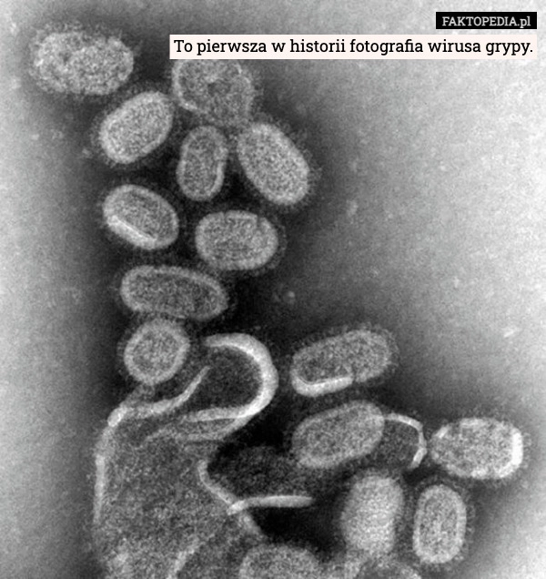 
    To pierwsza w historii fotografia wirusa grypy.