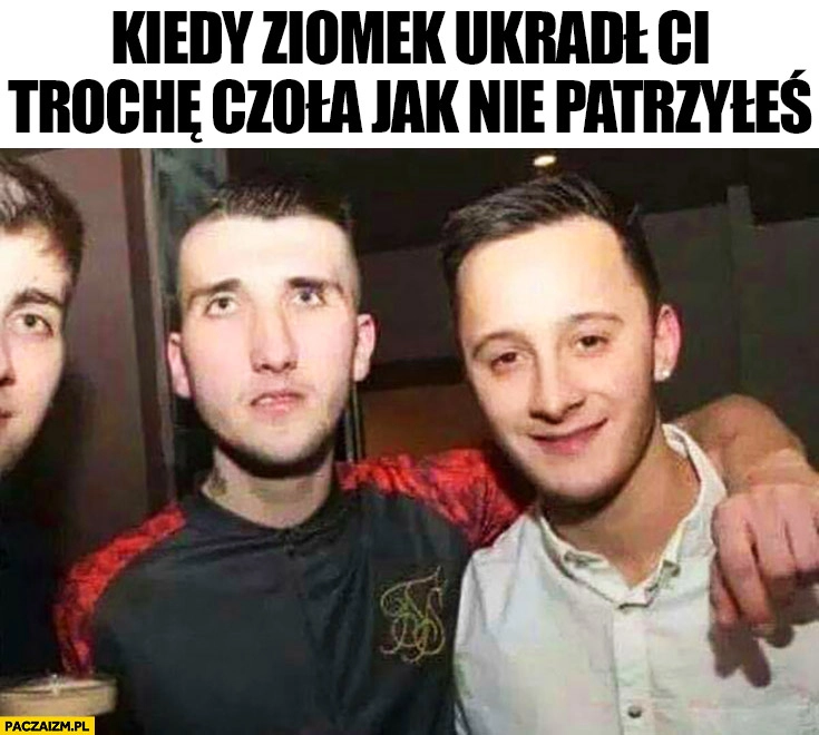 
    Kiedy ziomek ukradł Ci trochę czoła jak nie patrzyłeś