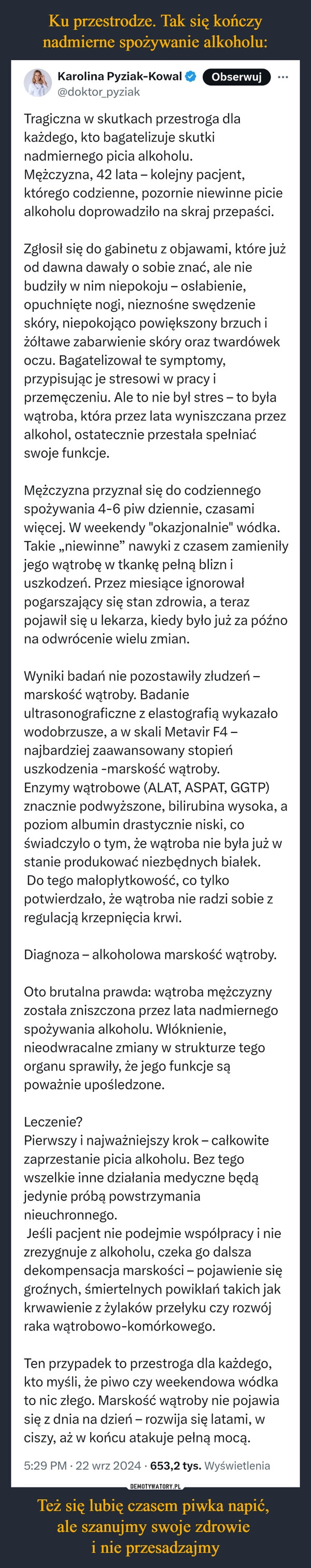 
    Ku przestrodze. Tak się kończy nadmierne spożywanie alkoholu: Też się lubię czasem piwka napić, 
ale szanujmy swoje zdrowie 
i nie przesadzajmy