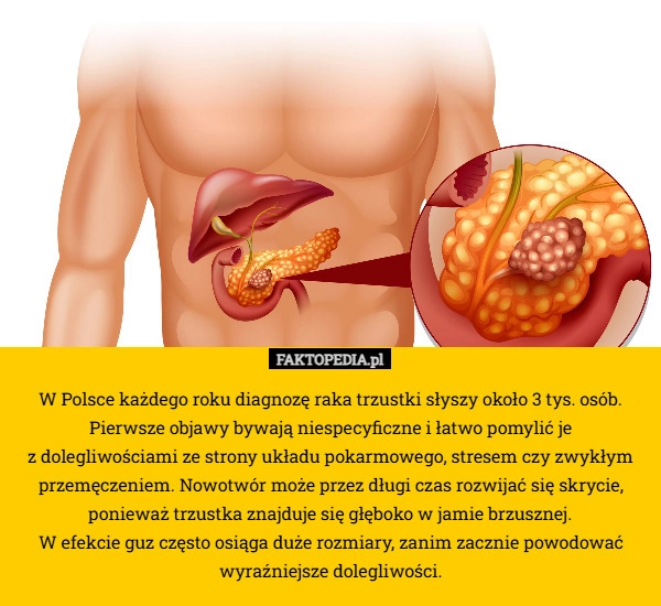 
    W Polsce każdego roku diagnozę raka trzustki słyszy około 3 tys. osób. Pierwsze