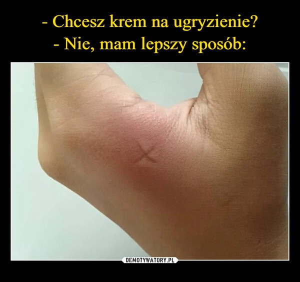 
    - Chcesz krem na ugryzienie?
- Nie, mam lepszy sposób: