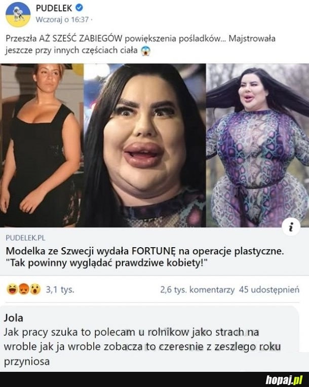 
    Modelka po operacjach