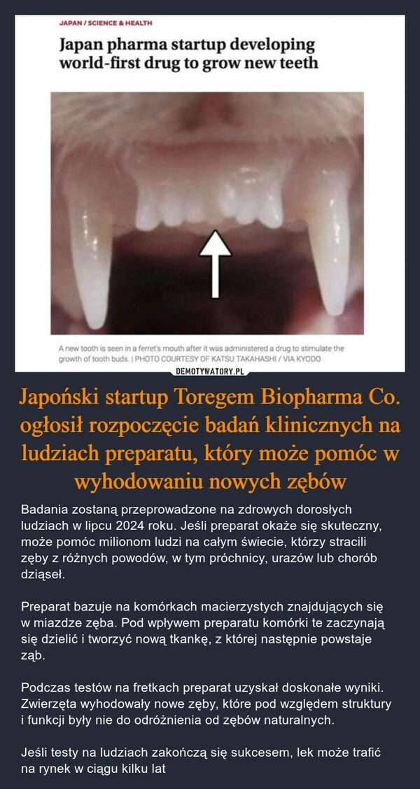 
    Japoński startup Toregem Biopharma Co. ogłosił rozpoczęcie badań klinicznych na ludziach preparatu, który może pomóc w wyhodowaniu nowych zębów