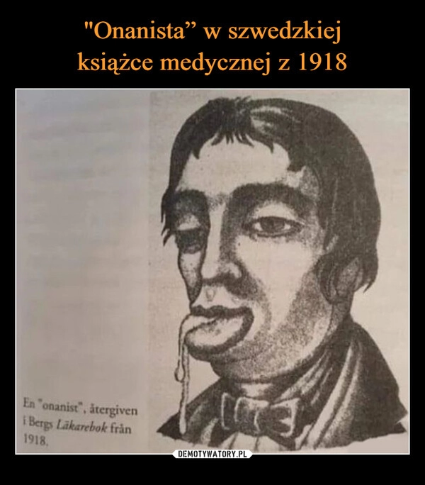 
    "Onanista” w szwedzkiej
książce medycznej z 1918