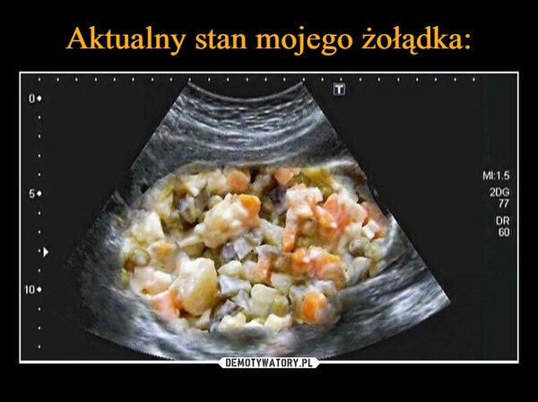 
    Aktualny stan mojego żołądka: