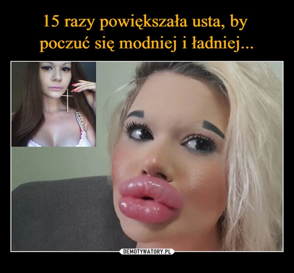 
    15 razy powiększała usta, by 
poczuć się modniej i ładniej...