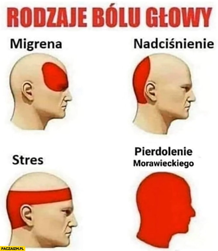 
    Rodzaje bólu głowy: migrena, stres, nadciśnienie, pierdolenie Morawieckiego cała głowa boli