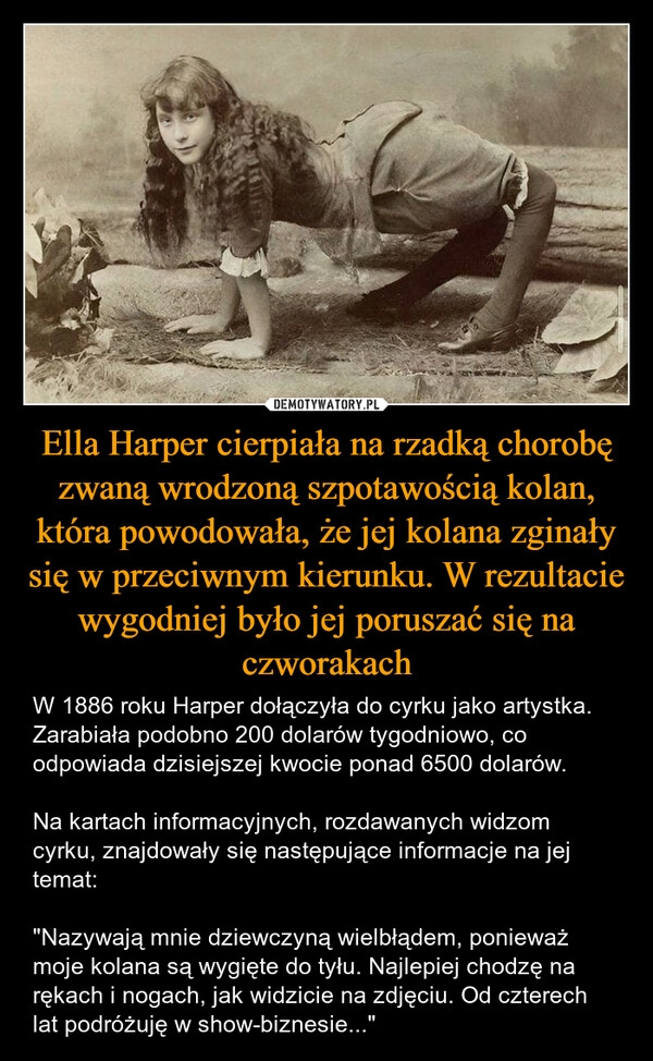 
    Ella Harper cierpiała na rzadką chorobę zwaną wrodzoną szpotawością kolan, która powodowała, że jej kolana zginały się w przeciwnym kierunku. W rezultacie wygodniej było jej poruszać się na czworakach