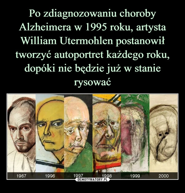 
    Po zdiagnozowaniu choroby Alzheimera w 1995 roku, artysta William Utermohlen postanowił tworzyć autoportret każdego roku, dopóki nie będzie już w stanie rysować