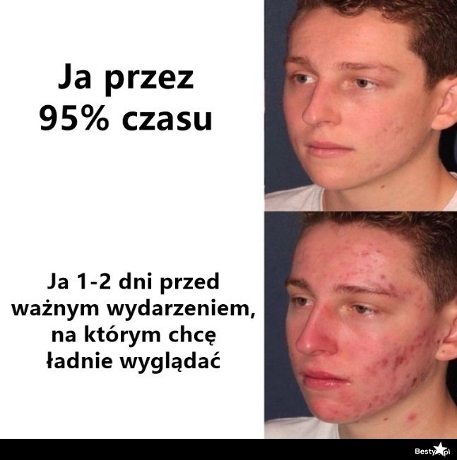 
    Przykryje się korektorem 