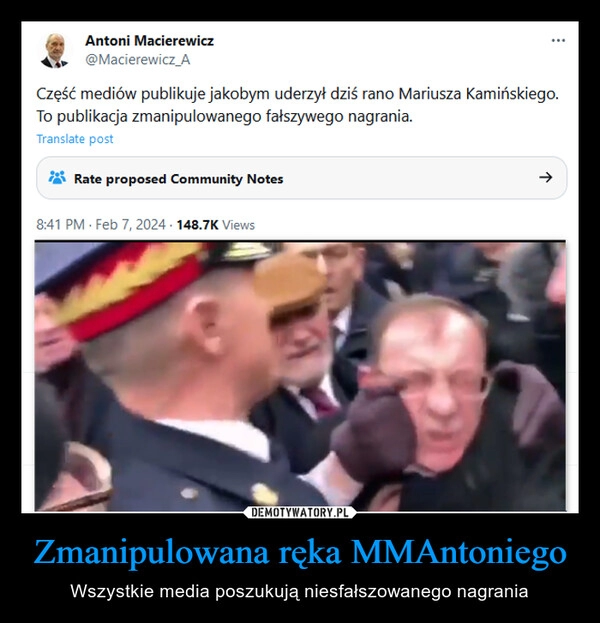 
    Zmanipulowana ręka MMAntoniego