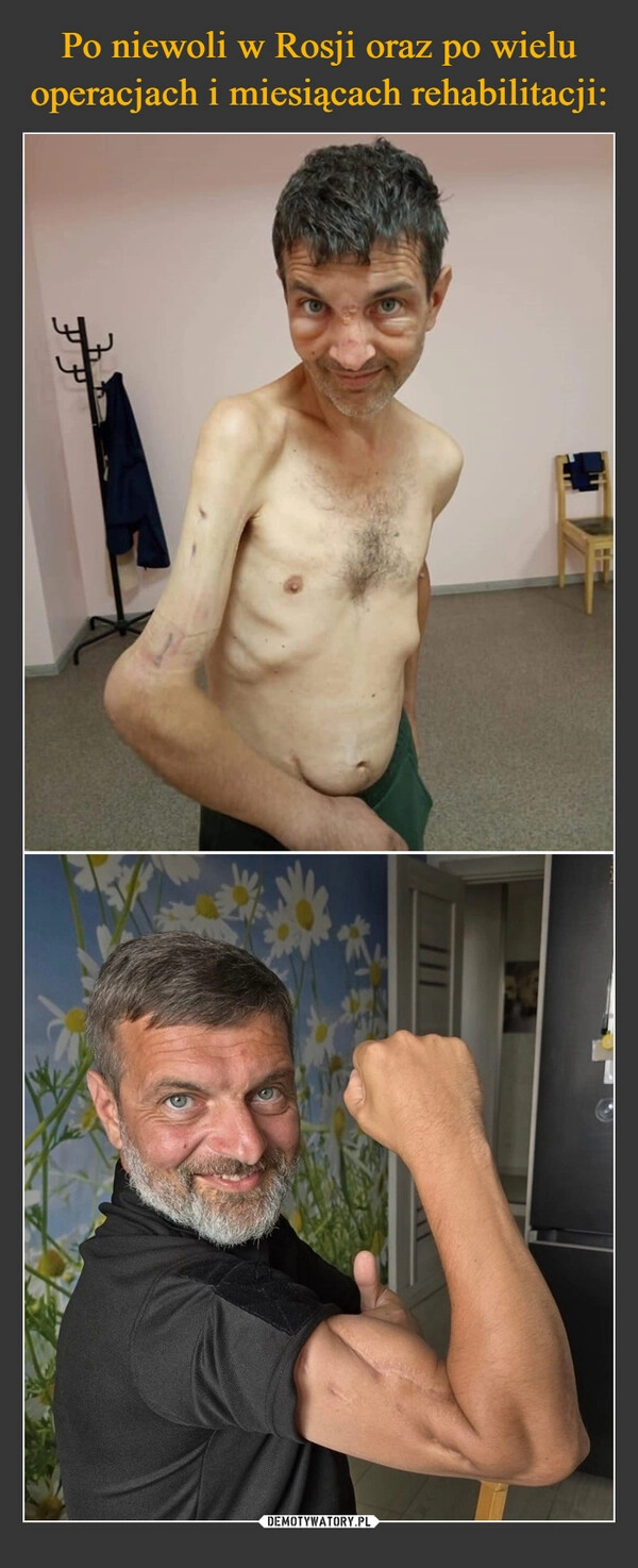 
    Po niewoli w Rosji oraz po wielu operacjach i miesiącach rehabilitacji: