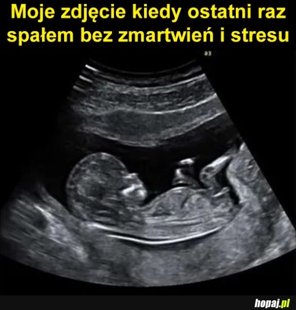 
    Kiedyś to było