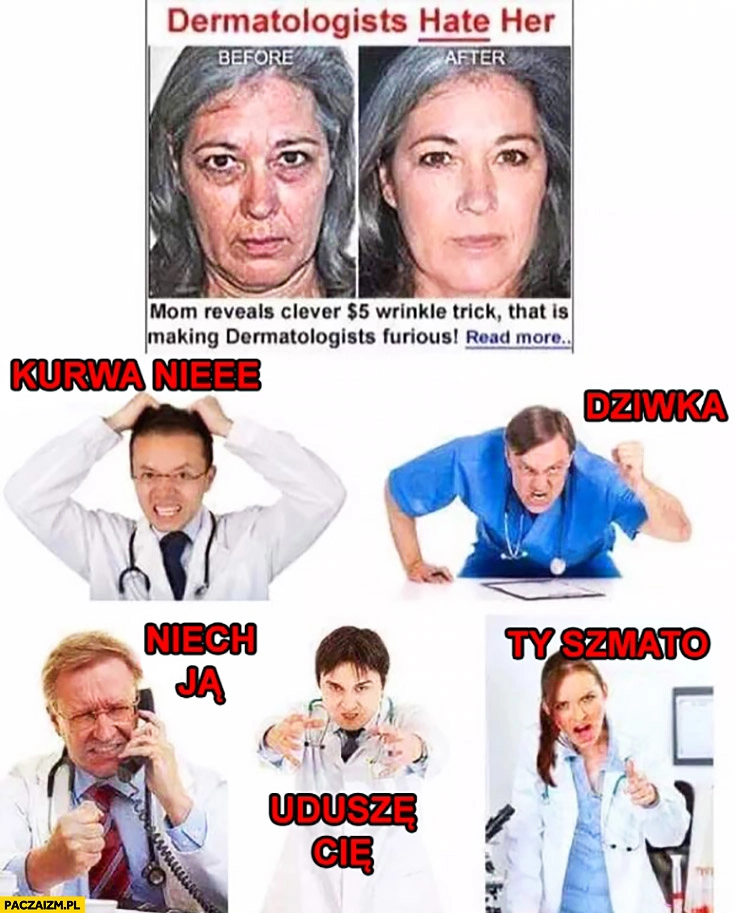 Dermatolodzy jej nienawidzą – niech ją, uduszę Cię, Ty szmato. Odkryła jeden dziwny sposób na