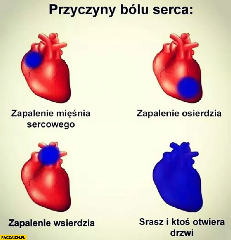 
    Przyczyny bólu serca srasz i ktoś otwiera drzwi, zapalenie mięśnia sercowego, zapalenie osierdzia, zapalenie wsierdzia