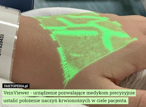 
    
			VeinViewer - urządzenie pozwalające medykom precyzyjnie ustalić położenie					