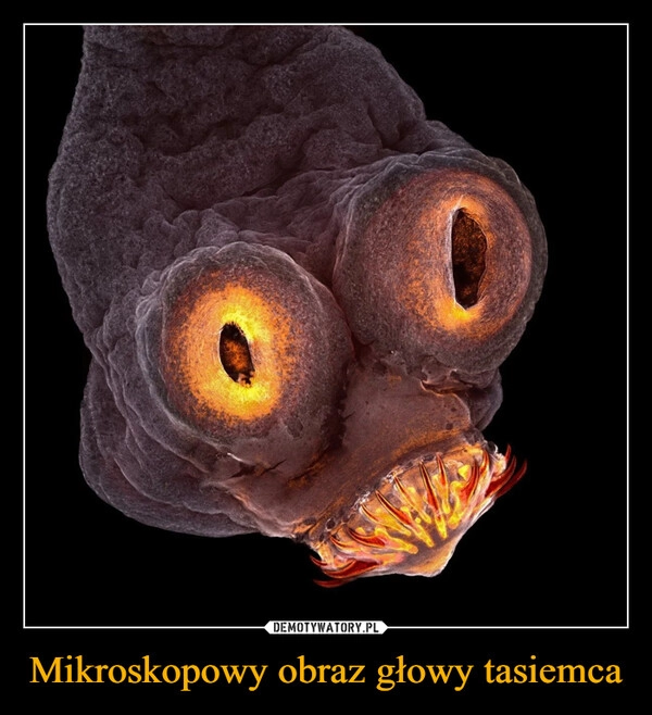 
    Mikroskopowy obraz głowy tasiemca