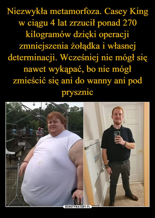 
    Niezwykła metamorfoza. Casey King w ciągu 4 lat zrzucił ponad 270 kilogramów dzięki operacji zmniejszenia żołądka i własnej determinacji. Wcześniej nie mógł się nawet wykąpać, bo nie mógł zmieścić się ani do wanny ani pod prysznic