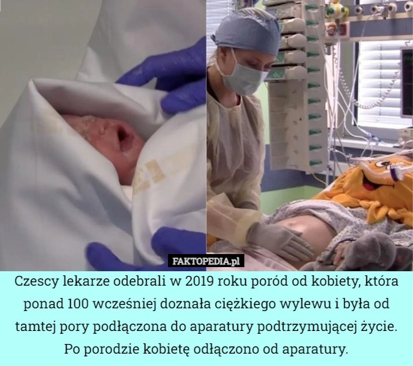 
    Czescy lekarze odebrali w 2019 roku poród od kobiety, która ponad 100 wcześniej