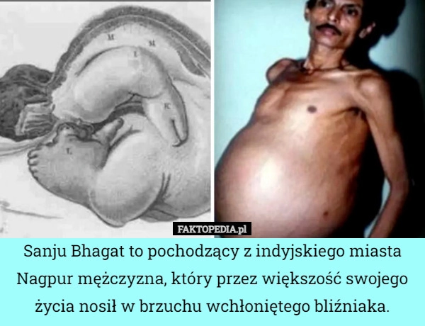 
    Sanju Bhagat to pochodzący z indyjskiego miasta Nagpur mężczyzna, który