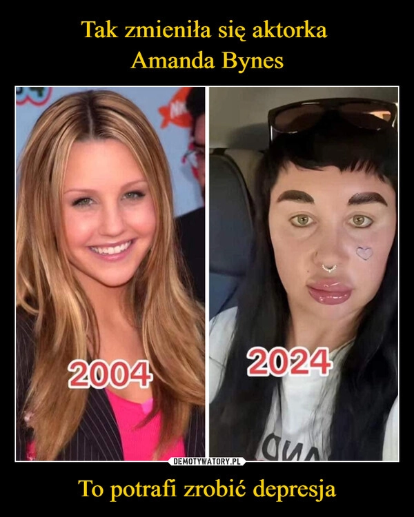 
    Tak zmieniła się aktorka 
Amanda Bynes To potrafi zrobić depresja