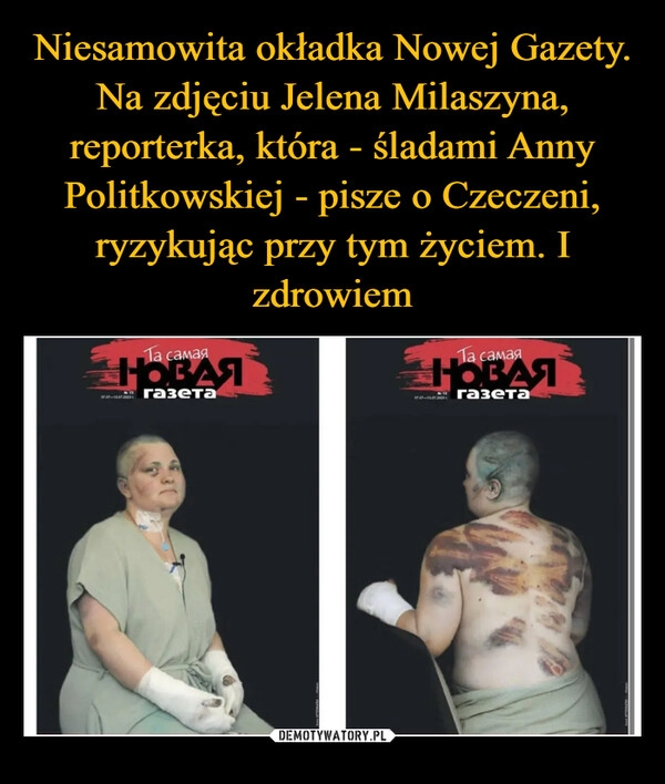 
    Niesamowita okładka Nowej Gazety. Na zdjęciu Jelena Milaszyna, reporterka, która - śladami Anny Politkowskiej - pisze o Czeczeni, ryzykując przy tym życiem. I zdrowiem