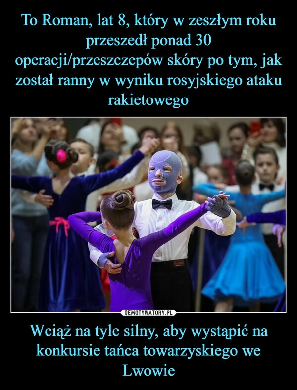 
    To Roman, lat 8, który w zeszłym roku przeszedł ponad 30 operacji/przeszczepów skóry po tym, jak został ranny w wyniku rosyjskiego ataku rakietowego Wciąż na tyle silny, aby wystąpić na konkursie tańca towarzyskiego we Lwowie