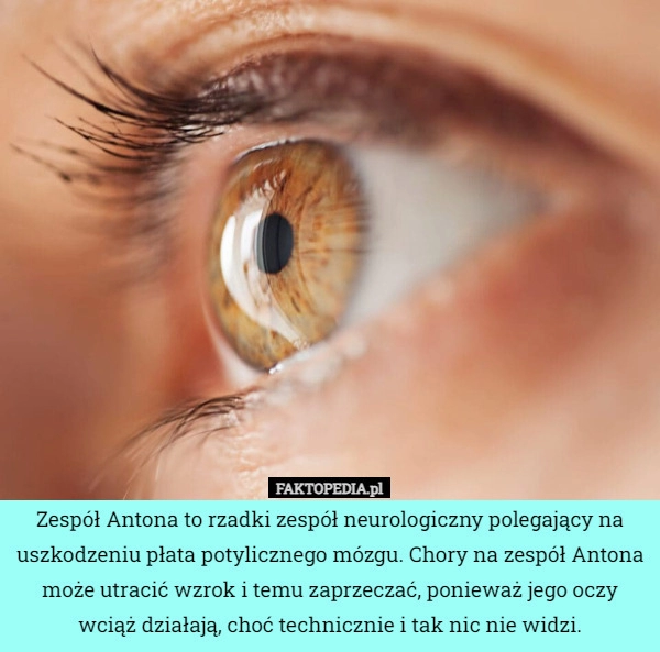 
    Zespół Antona to rzadki zespół neurologiczny polegający na uszkodzeniu płata