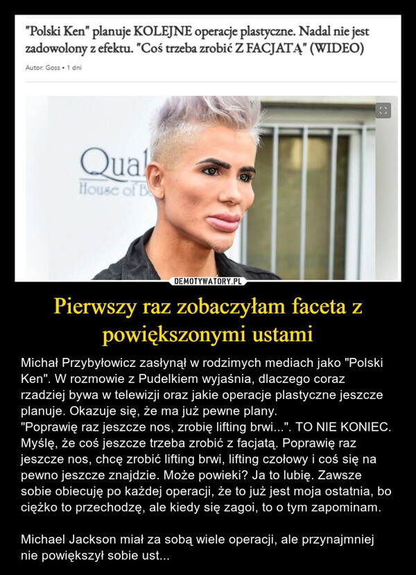 
    Pierwszy raz zobaczyłam faceta z powiększonymi ustami