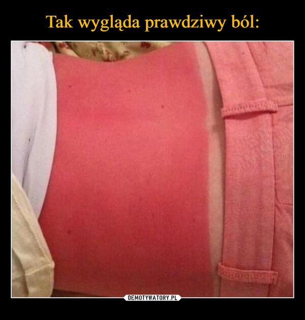 
    Tak wygląda prawdziwy ból: