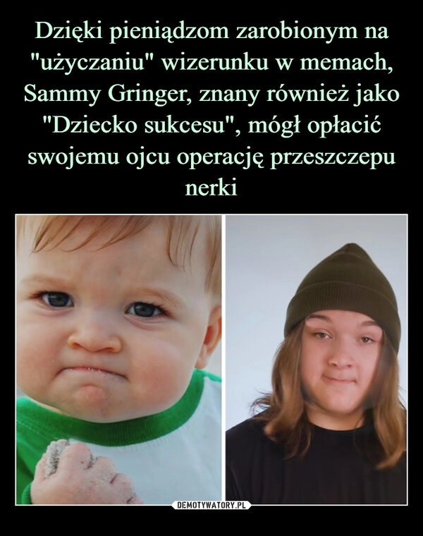 
    Dzięki pieniądzom zarobionym na "użyczaniu" wizerunku w memach, Sammy Gringer, znany również jako "Dziecko sukcesu", mógł opłacić swojemu ojcu operację przeszczepu nerki