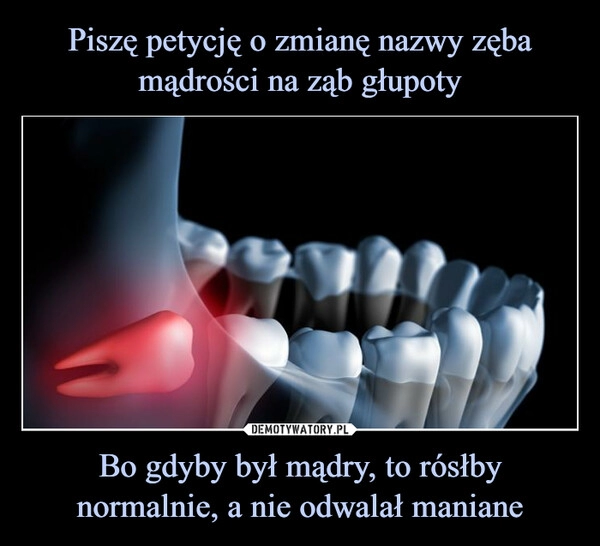 
    Piszę petycję o zmianę nazwy zęba mądrości na ząb głupoty Bo gdyby był mądry, to rósłby normalnie, a nie odwalał maniane