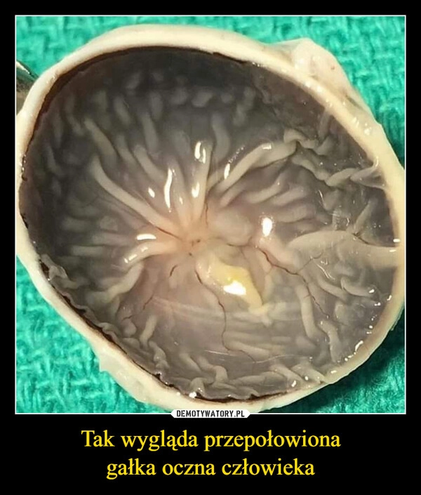 
    Tak wygląda przepołowiona
gałka oczna człowieka