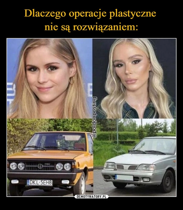 
    Dlaczego operacje plastyczne 
nie są rozwiązaniem: