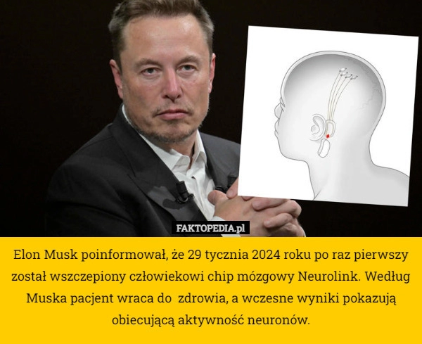 
    Elon Musk poinformował, że 29 tycznia 2024 roku po raz pierwszy został wszczepiony