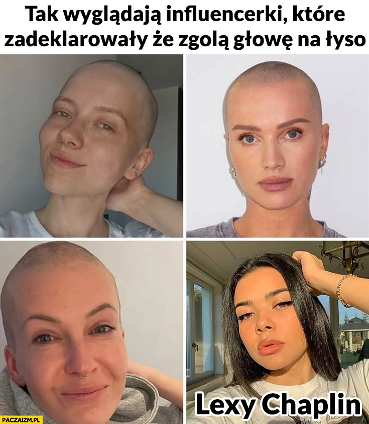 
    Tak wyglądają influencerki które zadeklarowały, że zgolą głowę na łyso Lexy Chaplin z włosami cancer fighters łatwogang