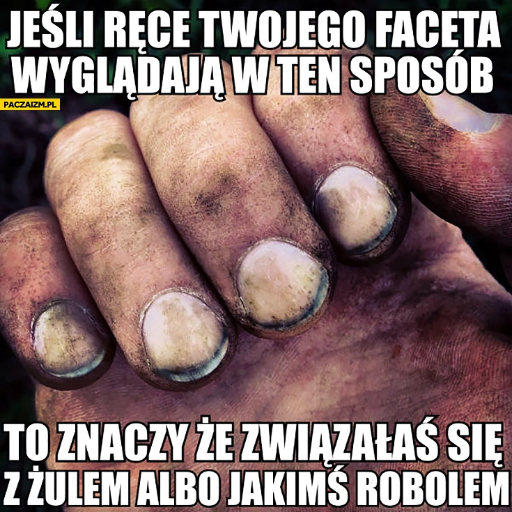 
    Jeśli ręce Twojego faceta wyglądają w ten sposób to znaczy, że związałaś się z żulem albo jakimś robolem