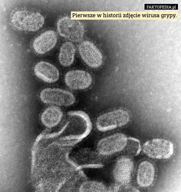 
    Pierwsze w historii zdjęcie wirusa grypy.