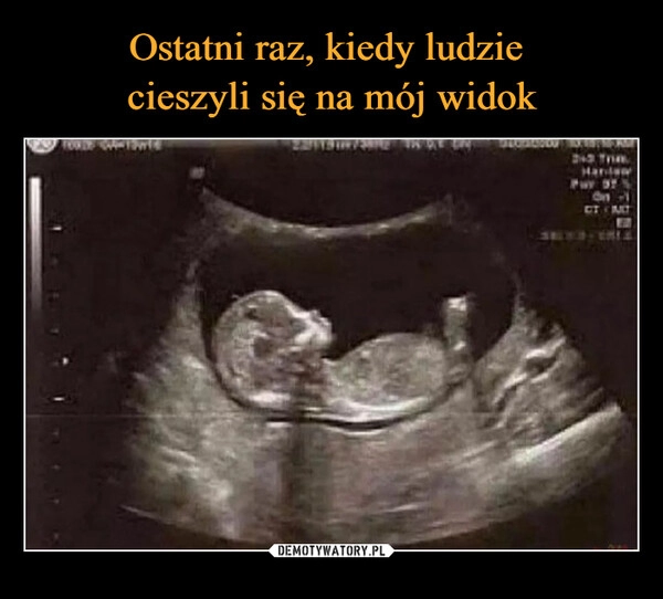 
    Ostatni raz, kiedy ludzie
cieszyli się na mój widok 