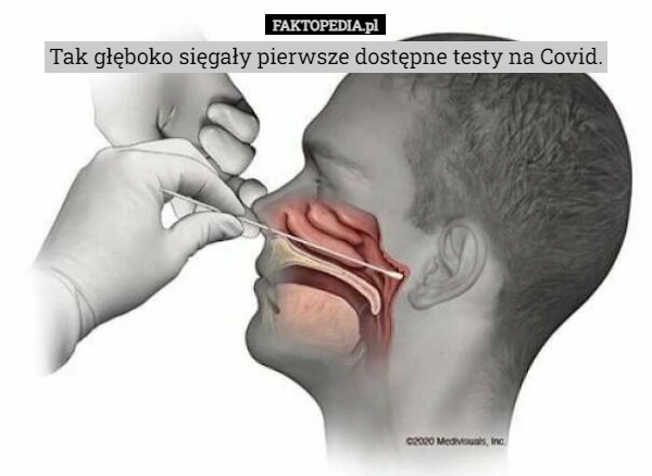 
    Tak głęboko sięgały pierwsze dostępne testy na Covid.