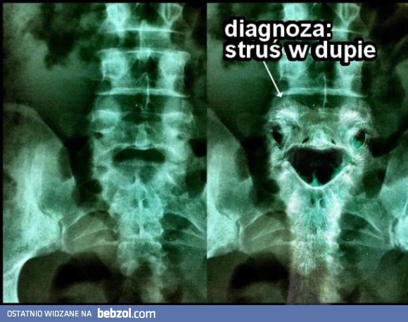 
    Moja diagnoza