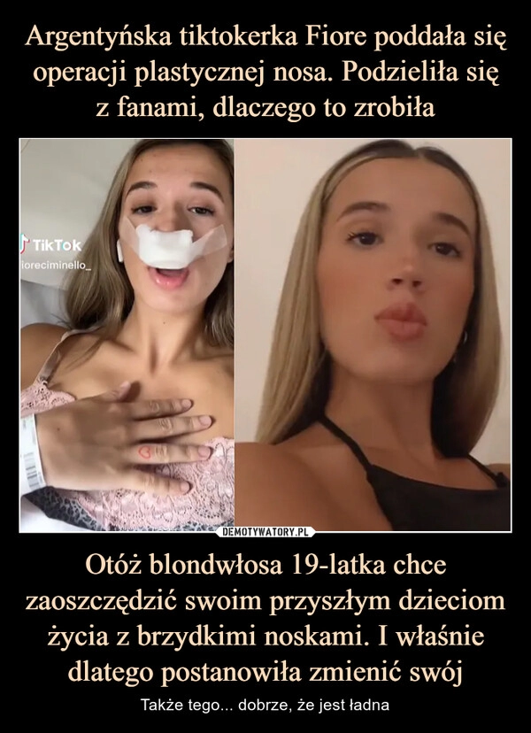 
    Argentyńska tiktokerka Fiore poddała się operacji plastycznej nosa. Podzieliła się z fanami, dlaczego to zrobiła Otóż blondwłosa 19-latka chce zaoszczędzić swoim przyszłym dzieciom życia z brzydkimi noskami. I właśnie dlatego postanowiła zmienić swój